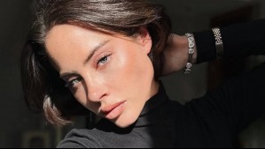 Este es el tratamiento contra la alopecia que tiene feliz a Ignacia Michelson: "Miren todo el pelo que tengo"