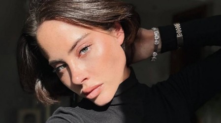 Este es el tratamiento contra la alopecia que tiene feliz a Ignacia Michelson: "Miren todo el pelo que tengo"