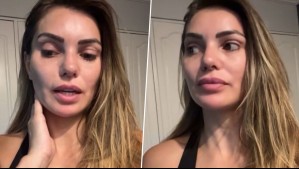 'Me dolía mucho': El complejo diagnóstico que dejó a Faloon Larraguibel en la clínica y sin poder moverse