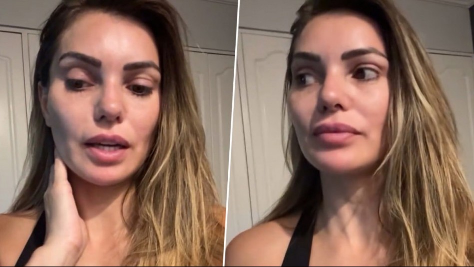 'Me dolía mucho': El complejo diagnóstico que dejó a Faloon Larraguibel en la clínica y sin poder moverse