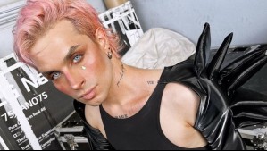 'De la nada, porque sí': Cantante Dani Ride denuncia violento ataque sufrido en la vía pública