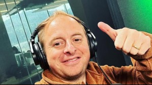 En cuestión de meses: Así fue el impresionante cambio de Coke Hevia tras someterse a implante capilar