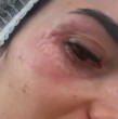 Rosario Bravo muestra tratamiento para las ojeras popularizado por las Kardashian
