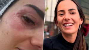 'No se asusten': Rosario Bravo muestra su tratamiento para las ojeras popularizado por 'las Kardashian'