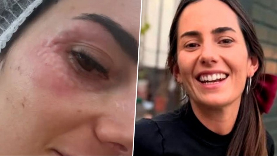 'No se asusten': Rosario Bravo muestra su tratamiento para las ojeras popularizado por 'las Kardashian'