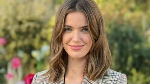 Millaray Viera actualiza su estado de salud a meses de revelar que padece enfermedad autoinmune