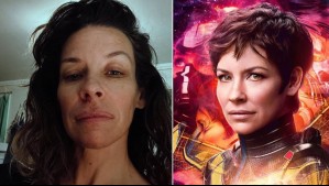 ¿Qué le pasó a Evangeline Lilly? La actriz de Lost y Marvel revela que tiene daño cerebral