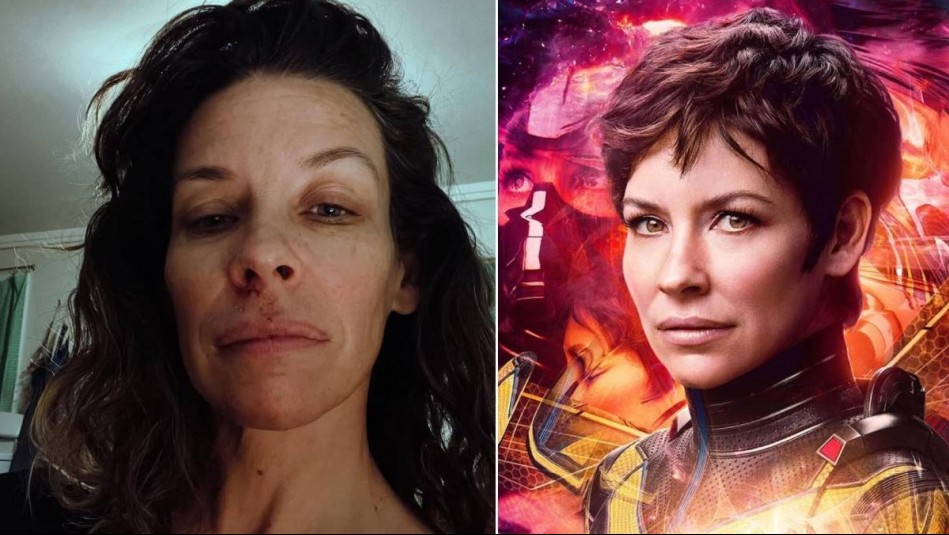 ¿Qué le pasó a Evangeline Lilly? La actriz de Lost y Marvel revela que tiene daño cerebral