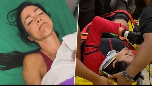 El Internado React: Así quedó Pops luego de la grave lesión en su brazo