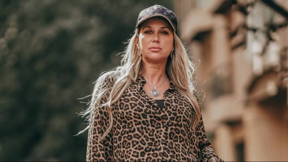 'Esa es la verdadera Fla': Flaviana Seeling se muestra al natural y revela uno de sus tratamientos estéticos