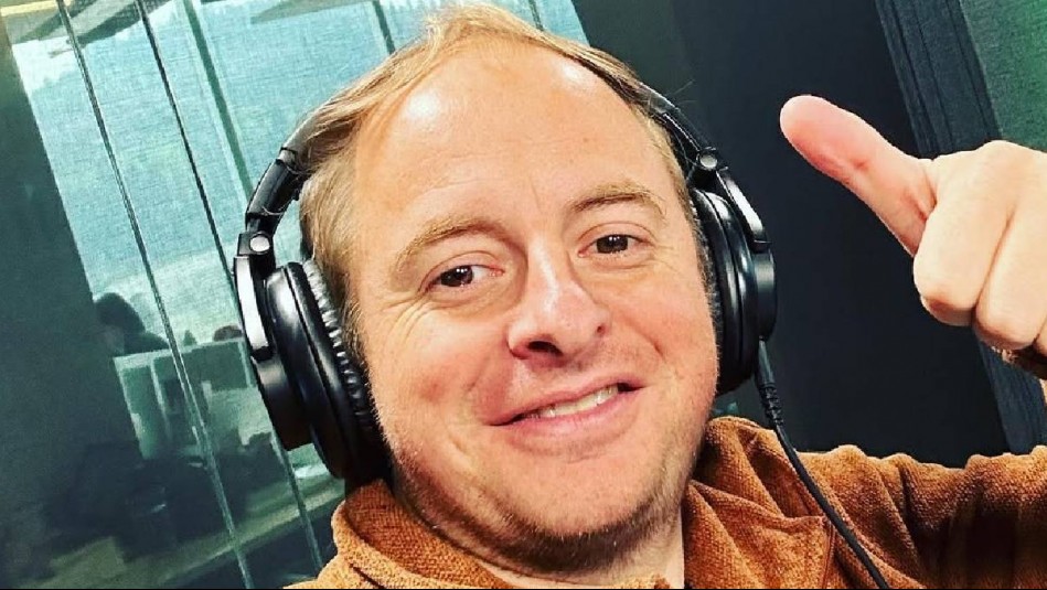 El increíble antes y después de Coke Hevia a un año de su implante capilar: 'No fue un caso fácil'