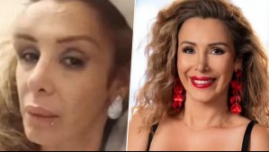 'Siento un botellazo en la cabeza': Romina Sáez denuncia que fue víctima de golpiza en local nocturno