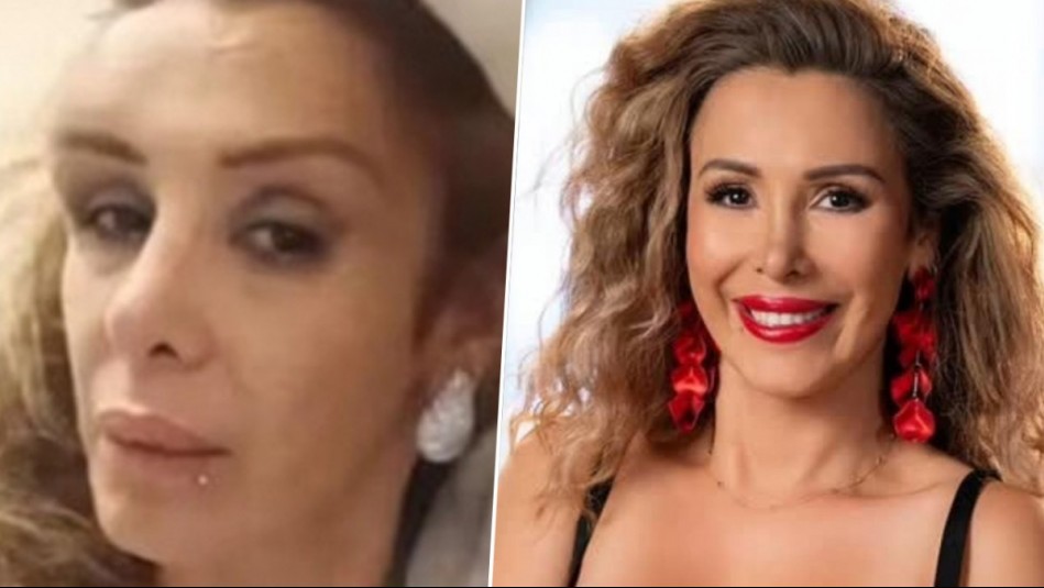 'Siento un botellazo en la cabeza': Romina Sáez denuncia que fue víctima de golpiza en local nocturno