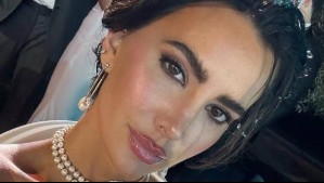 'No lo puedo creer': Aylén Milla maravillada por el crecimiento de su melena a dos años de las quimios