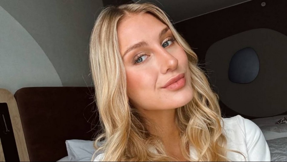 Adiós acné: Blu Dumay revela los consejos que sigue para lucir un rostro libre de granos