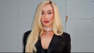 Fran Maira protagonizó accidente vehicular en La Dehesa: Impactó a motorista que se mantiene grave