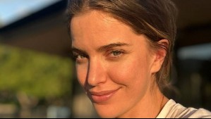 Millaray Viera cuenta cómo se recuperó de la crisis tiroidea que complicó su vida: 'Me siento más fuerte'