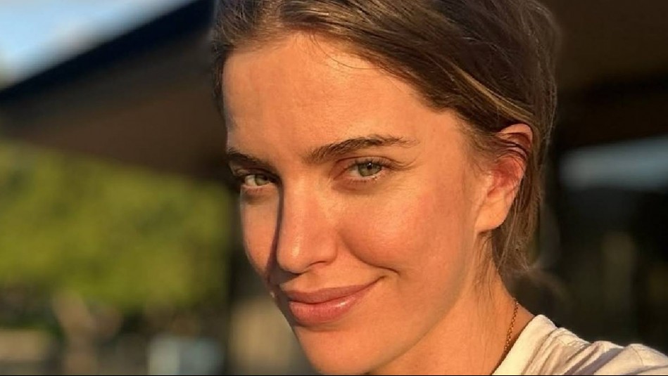 Millaray Viera cuenta cómo se recuperó de la crisis tiroidea que complicó su vida: 'Me siento más fuerte'