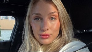 El antes y después de Blu Dumay con los masajes brasileros: 'Mil veces más marcada'