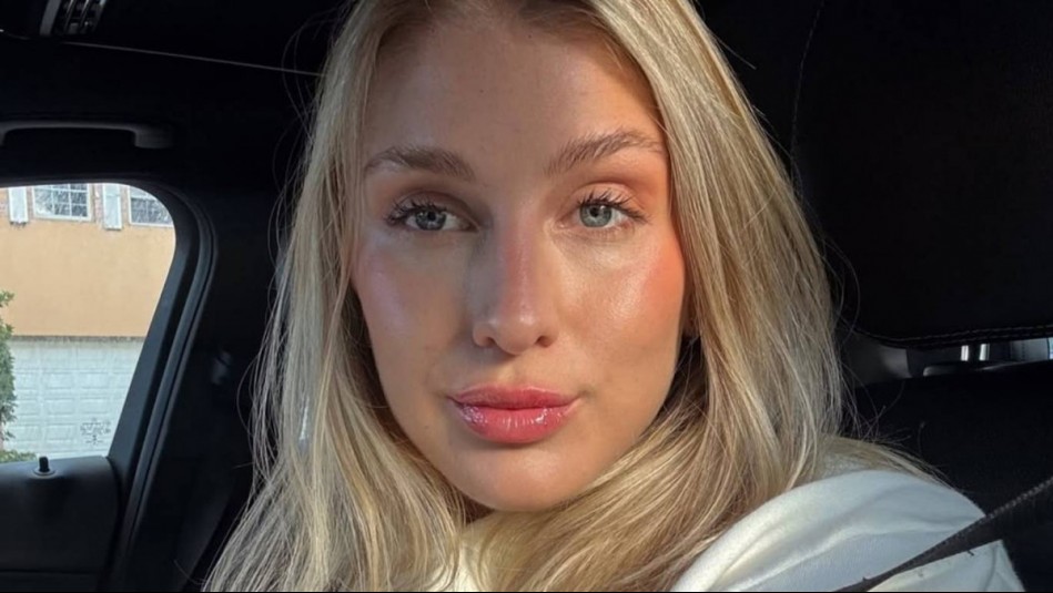 El antes y después de Blu Dumay con los masajes brasileros: 'Mil veces más marcada'