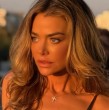 La actriz Denise Richards se sometió a una cirugía estética facial completa, una intervención que estuvo a cargo del especialista Ben Talei. Revisa cómo luce ahora.