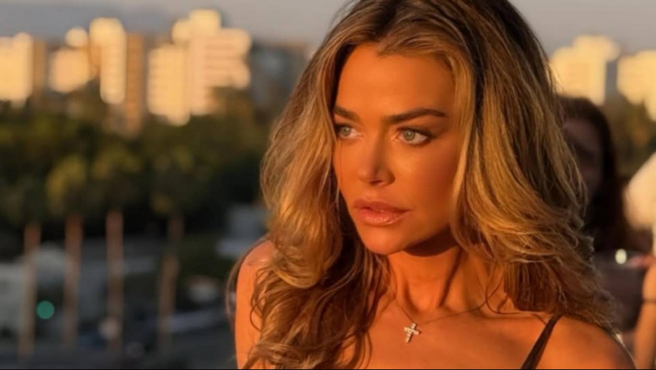 'Su rostro dorado es suyo otra vez': El antes y después de Denise Richards tras someterse a cirugía estética