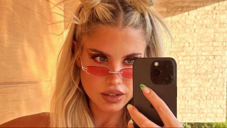 'Tenía todo tapado...': Coté López debió ser operada y explica la causa de sus intensos dolores