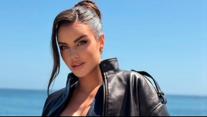 'Tomé la decisión errónea': Emilia Dides reconoce retoque estético en su rostro y admite estar arrepentida