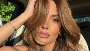 'No importa si es invierno o verano': El secreto detrás del bronceado perfecto de Gala Caldirola