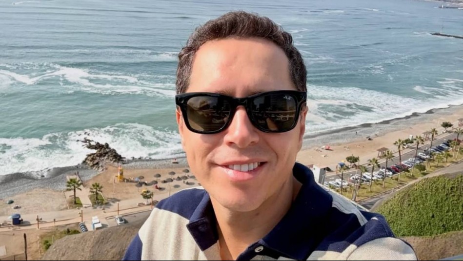 Los tratamientos de Karol Lucero para prevenir la alopecia: 'Tengo fe de que crezca un poco más de pelito'