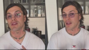 Nicolás Solabarrieta muestra el antes y después de su borrado de tatuajes tras intento fallido: 'Me quemaron'