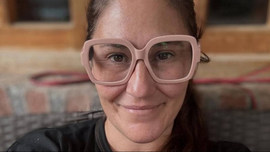 Belén Mora y su percance tras aplicarse una crema en el rostro: 'Ya está más deshinchado'