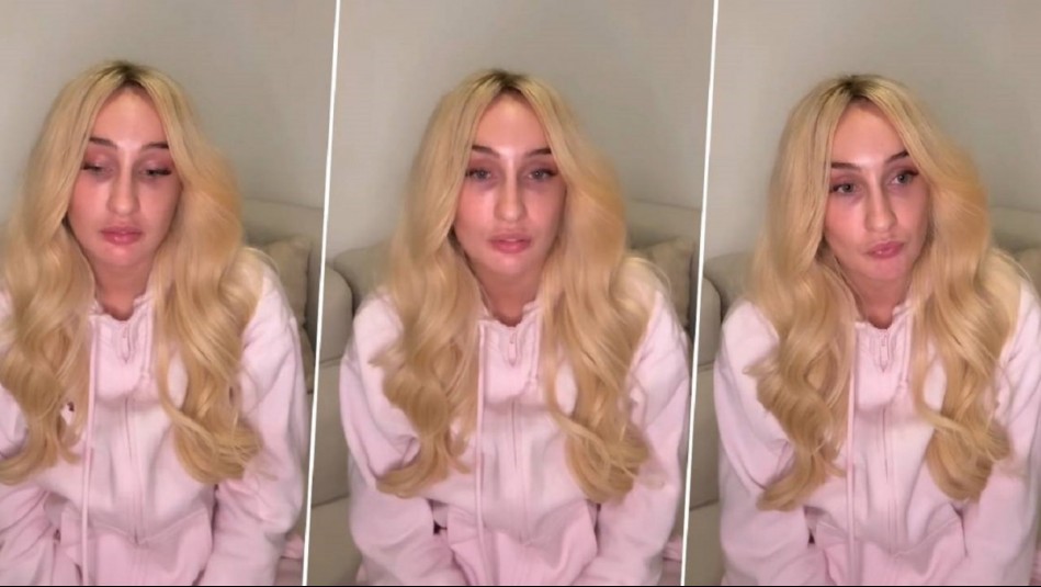 'La vida en un segundo te puede cambiar': Fran Maira relata accidente de tránsito que dejó grave a motorista