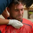 En el capítulo 128 de El Internado, Tom Brusse tuvo que ser atendido por el equipo médico en plena competencia por equipos.