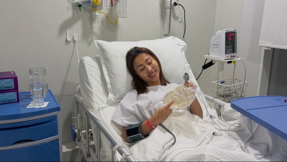 'Se fue una parte del pasado': Naya Fácil revela los motivos para cambiar sus implantes mamarios