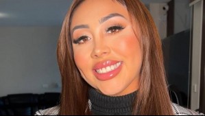 'Iba a quedar con dos espaldas': Naya Fácil revela la razón por la que no dejó su busto sin implantes