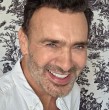 El fotógrafo Jordi Castell compartió los resultados de su implante de cabello que se hizo hace un año.