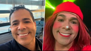 '¿Les gusta el pelao?': Pastelito impacta con radical cambio de look y adelanta intervención estética