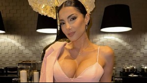 Flavia Medina explica el procedimiento estético que se hizo en su rostro: 'No se trata de verme perfecta'