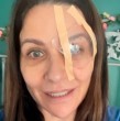 Revisa acá la operación a la que se tuvo que someter Savka Pollak y que la dejó con un parche en su ojo.