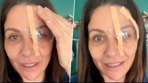 La compleja patología que dejó a Savka Pollak con un parche en su ojo: 'El postoperatorio fue doloroso'