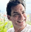 Cristián de la Fuente explica el tipo de tratamiento con láser que aplican en la piel de su rostro para lograr un lifting facial sin cirugía