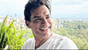 'Para los que me preguntaron': Así es el lifting facial sin cirugía al que se sometió Cristián de la Fuente