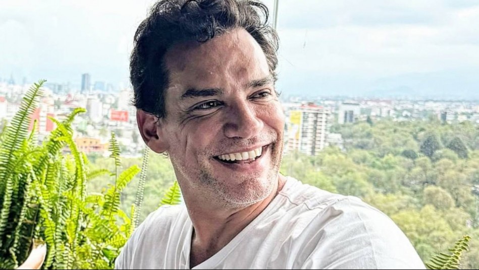 'Para los que me preguntaron': Así es el lifting facial sin cirugía al que se sometió Cristián de la Fuente