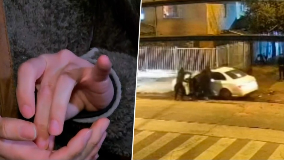 'Me tomaron del pelo y pegaron en la cabeza': El crudo relato de víctima de violento abordazo en Maipú