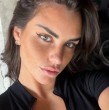 Un par de días después de su operación de emergencia por apendicitis, Emilia Dides envía un mensaje a sus seguidores