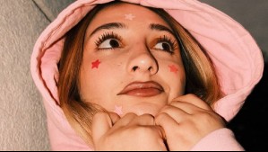 Paso a paso: La Carlita comparte su rutina de skincare coreano para combatir las manchas del acné