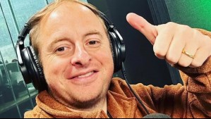 Coke Hevia muestra lo mucho que ha crecido su pelo: Periodista se realizó un implante capilar hace meses