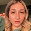 La Carlita ha compartido algunos de sus procedimientos estéticos en redes sociales. Esta vez, con una fotografía evidenció un gran cambio de su rostro.
