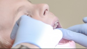 Cofinanciado por FONIS y Pepsodent: Estudio de U. de los Andes reveló disminución de caries en niños